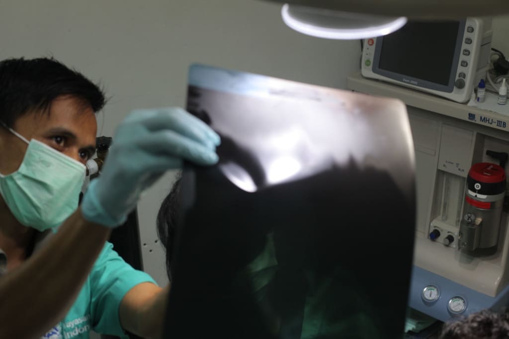 Tim medis IAR Indonesia menunjukan hasil rontgen Muka. Foto: Reza Septian/IAR Indonesia.